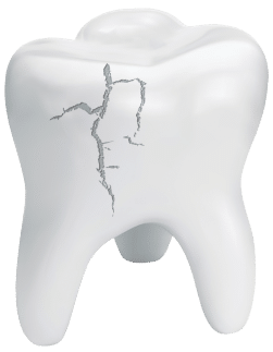 Emergency Dentist Pasadena
