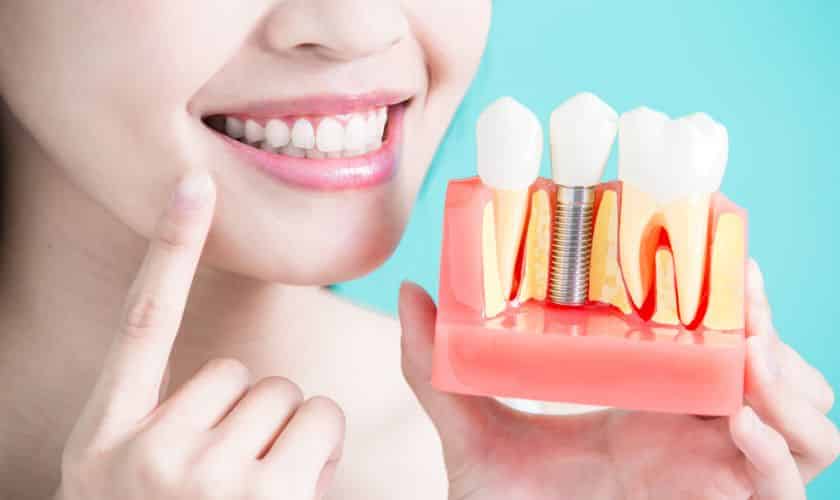Dental Implants and Oral Health