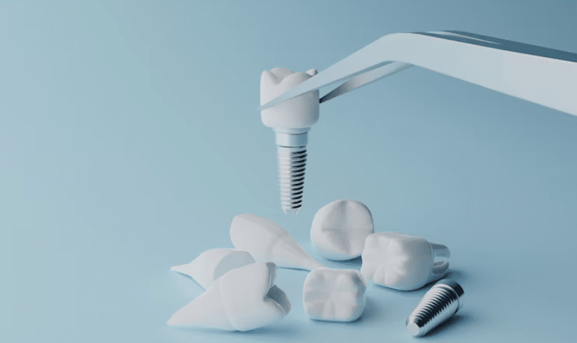 Longevity Of Your Dental Implants