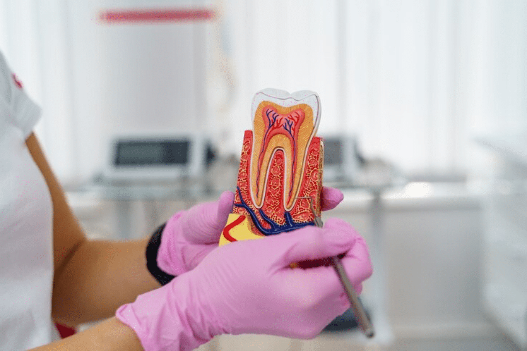 essential tips after root canal therapy