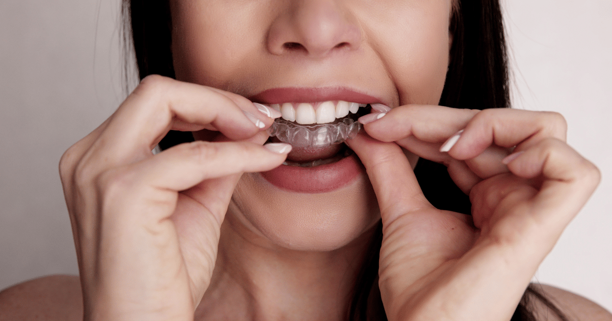 Do Clear Aligners Hurt_ What to Expect During Your Treatment