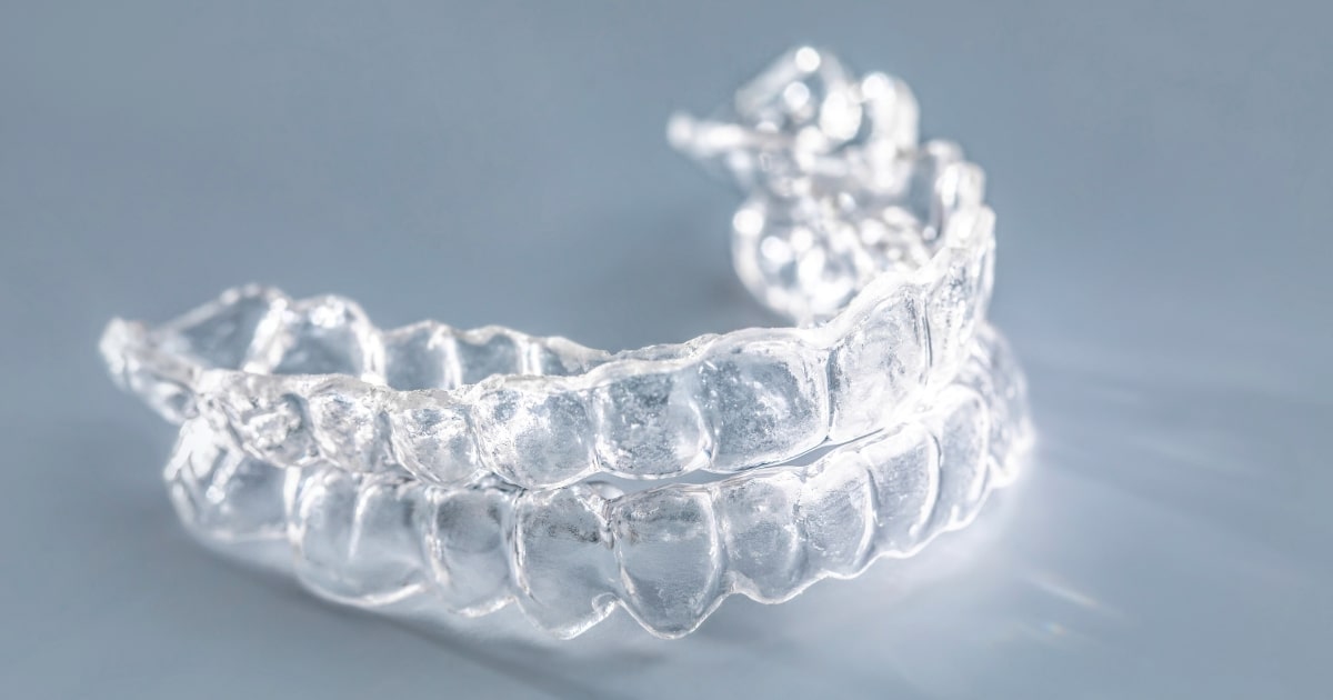 unexpected benefits of clear aligners