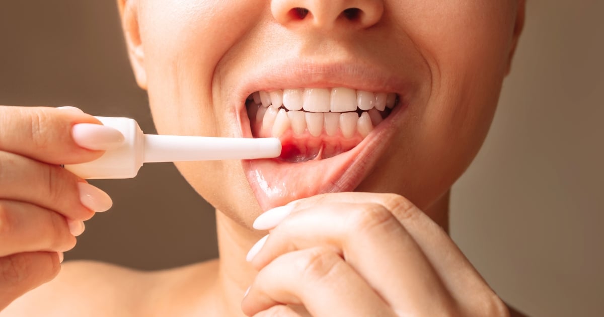 How to Stop Bleeding Gums