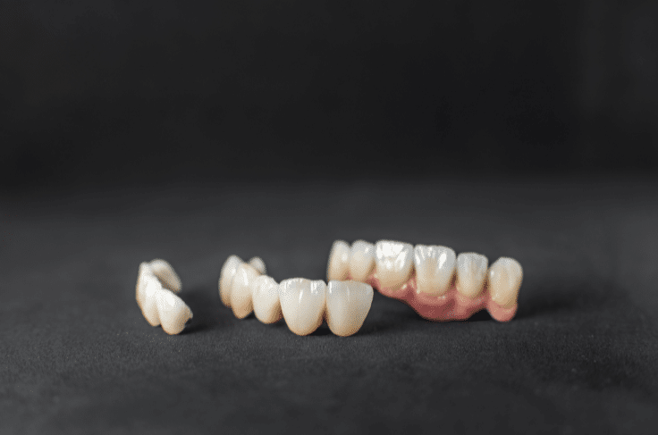Same-Day Crowns Are Trending in Dentistry