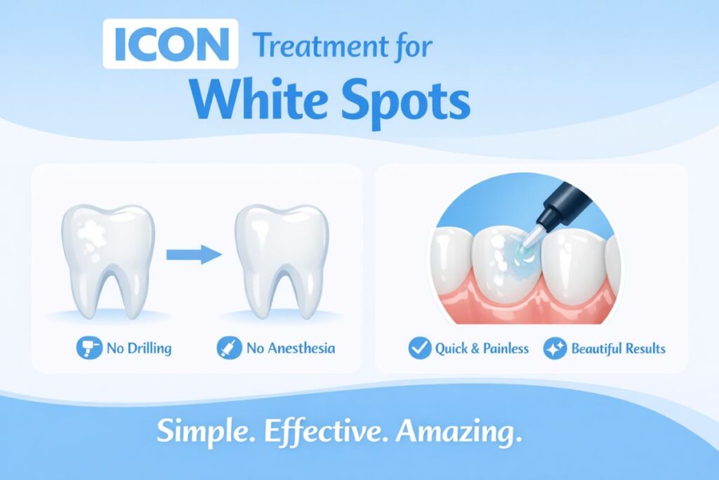 ICON Treatment for White Spots